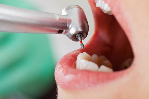 Best Emergency Broken Tooth Repair in Mary Esther, FL